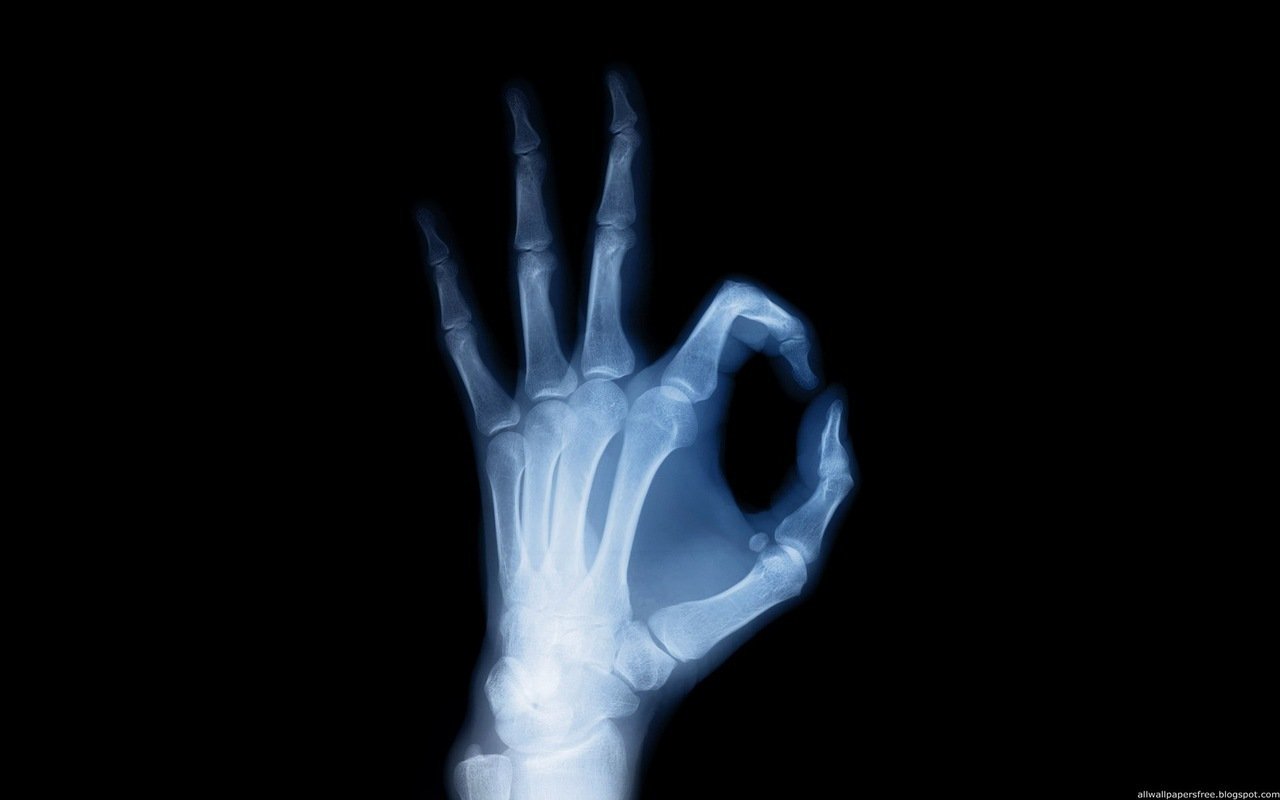 x ray